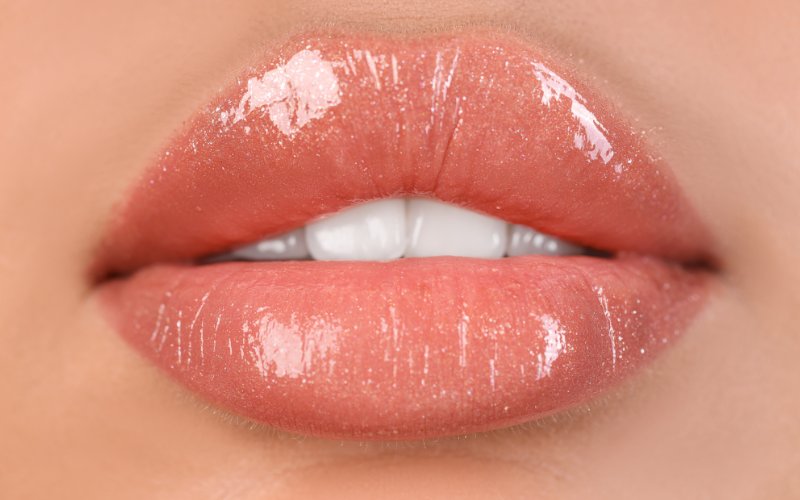 Aumento de labios madrid